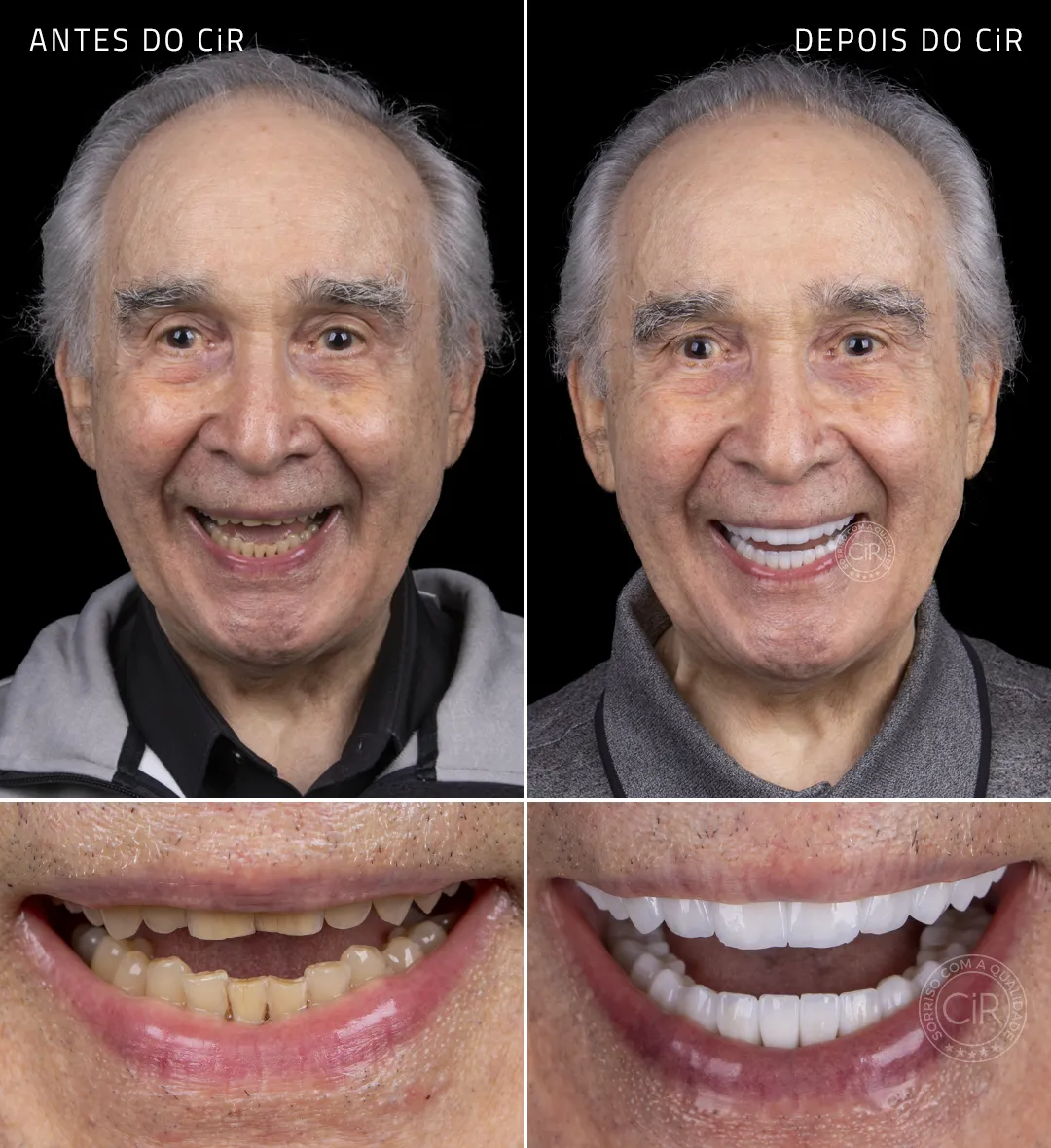 jose-fonseca-rosto-sorriso-antes-depois